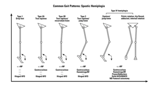 Abnormal gait patterns in children with hemiplegia